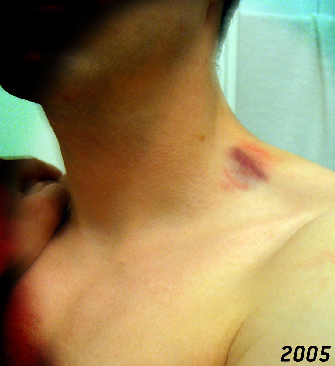 KleinerMuck 🙇 tweet media