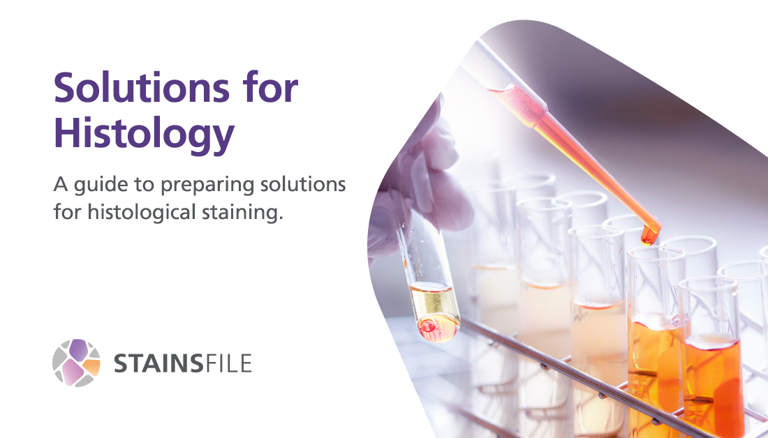 StainsFile tweet media