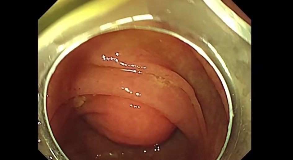 VideoGIE Journal tweet media