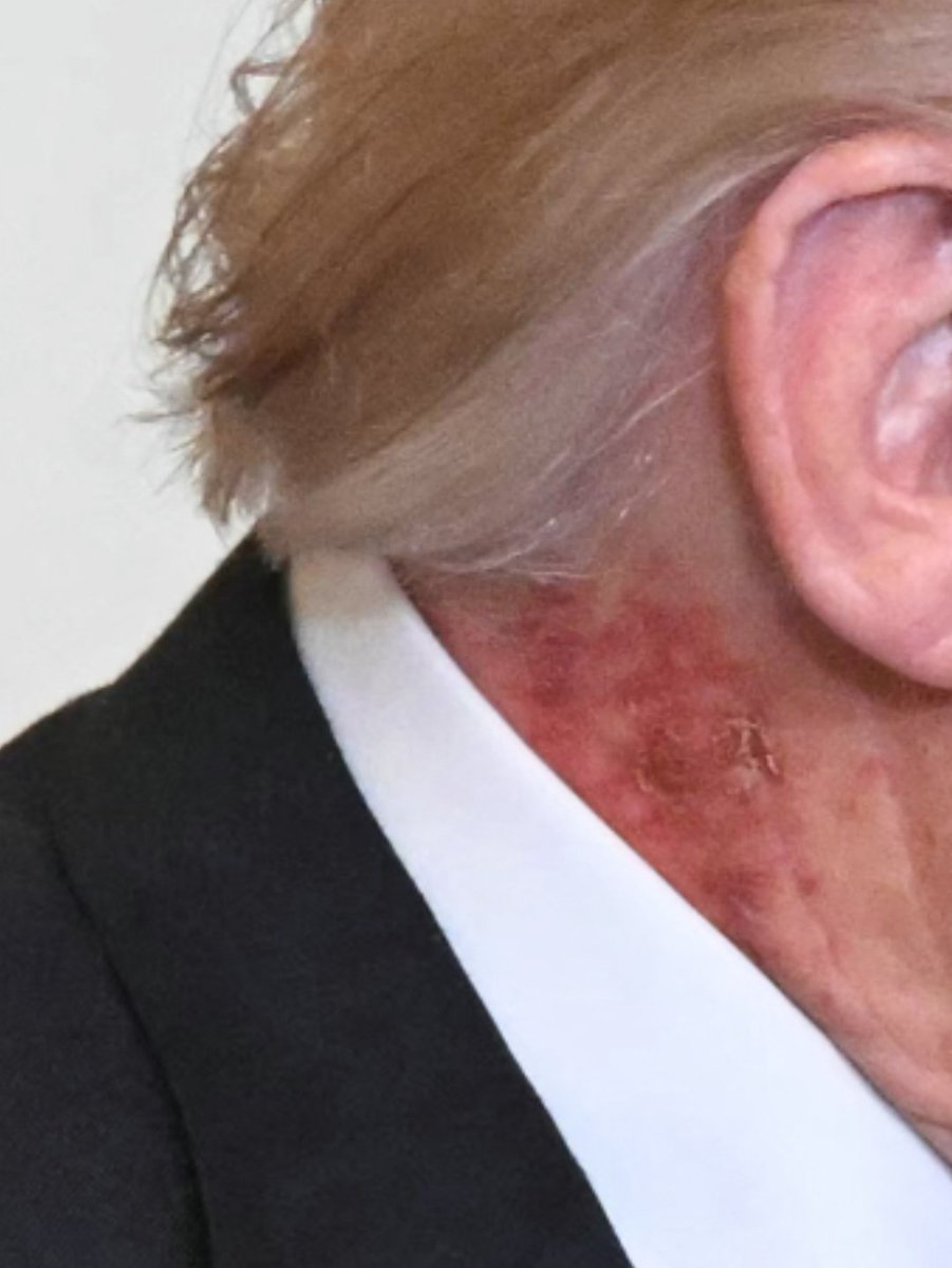 <a href="/atrupar/">Aaron Rupar</a> President Syphilis