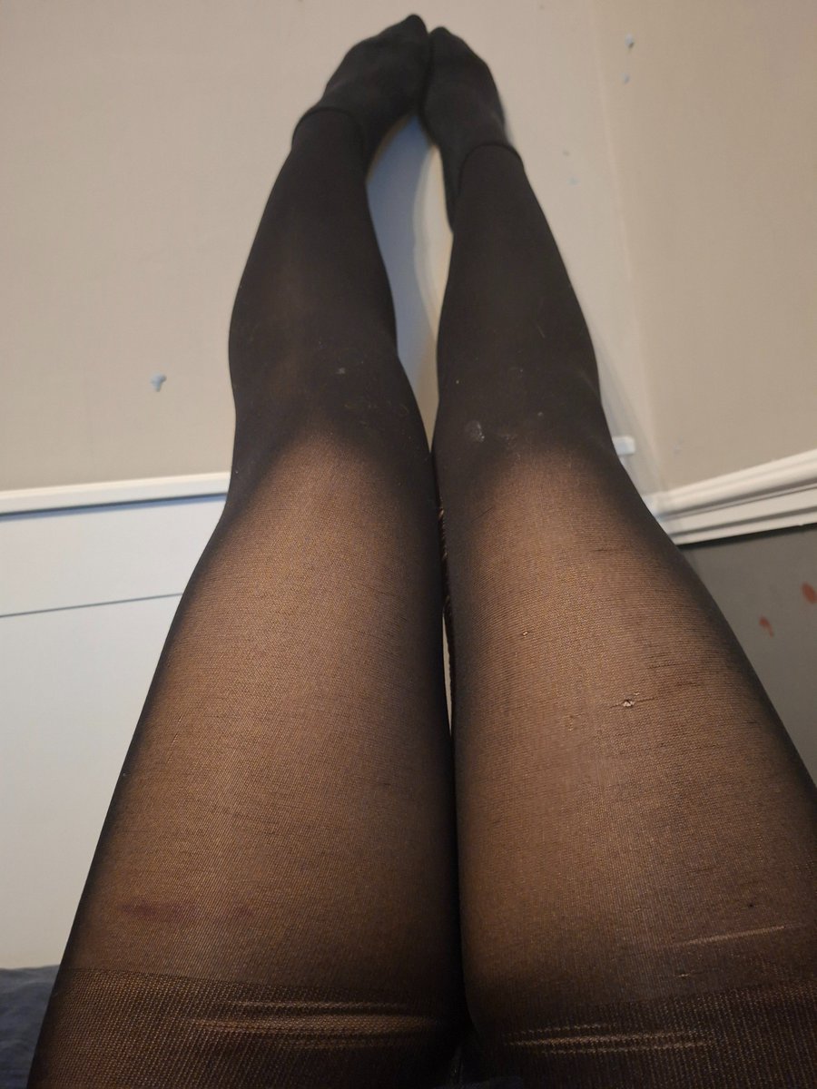 Roxy__Rockz's tweet photo. Legs rn.. they disgust me so much but they will be better soon https://t.co/CUDiucEAHE