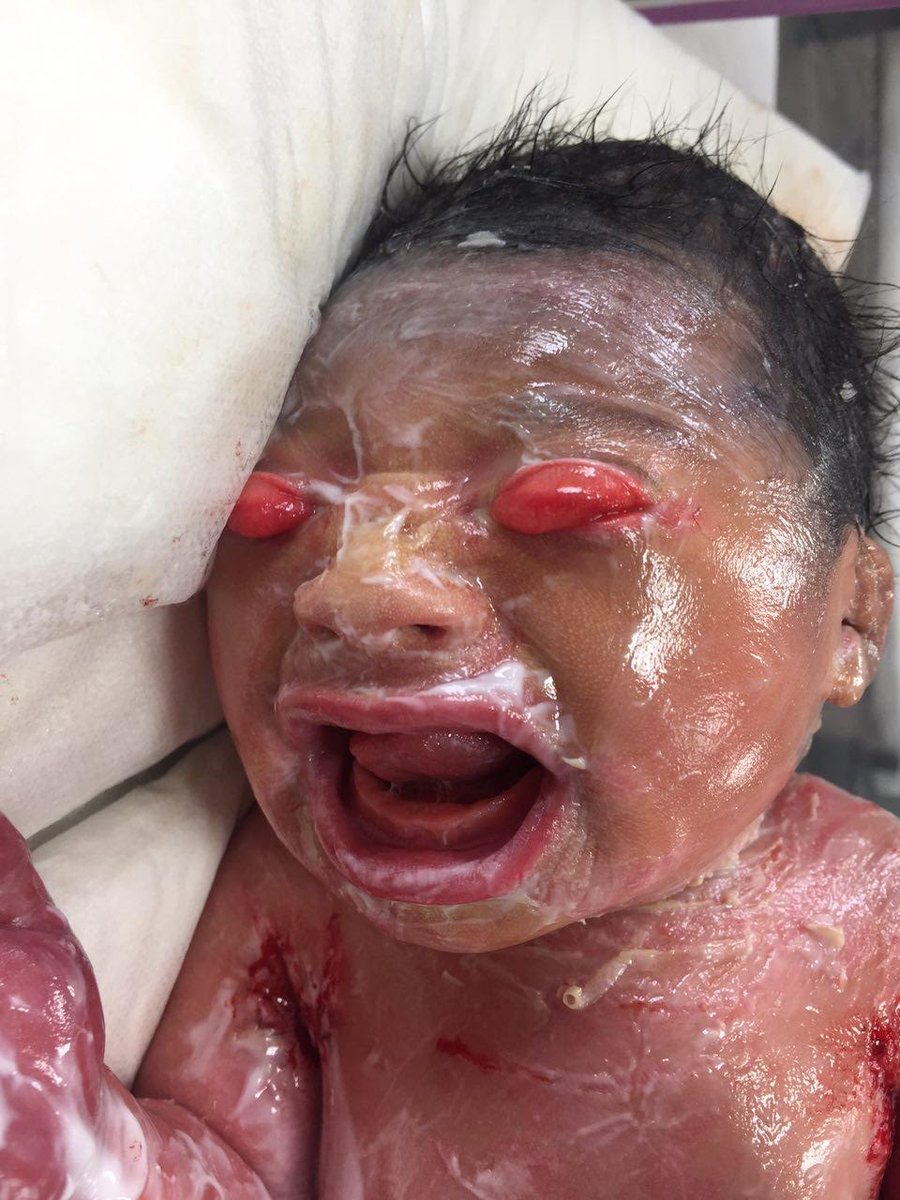 IhabFathiSulima's tweet photo. What is the diagnosis? https://t.co/3b1RCZ8oq2