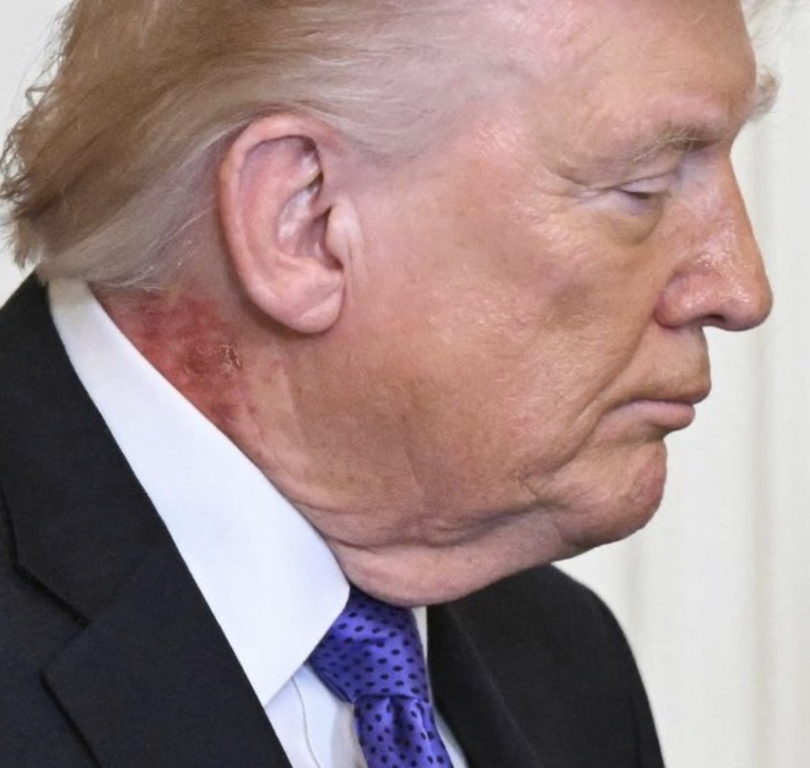 What is wrong with Trump?