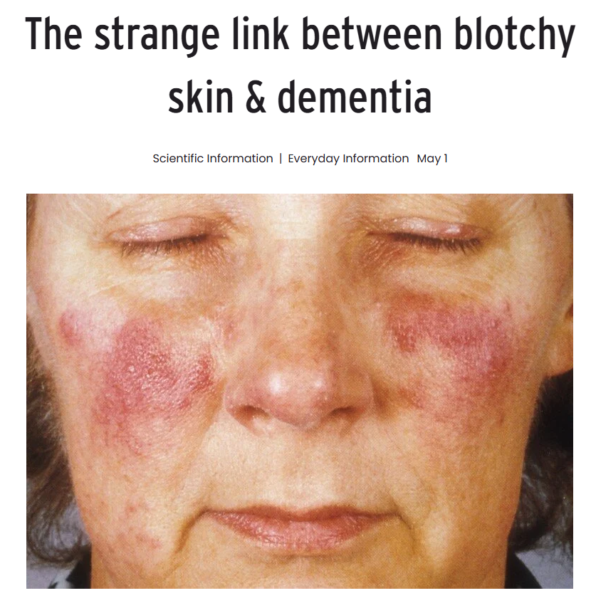 Frank James - Tweeterer tweet media