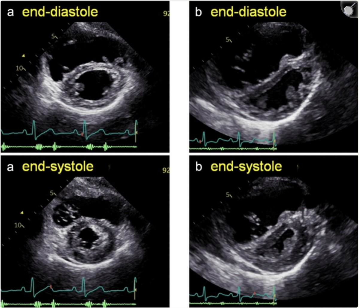 POCUSmedicine tweet media