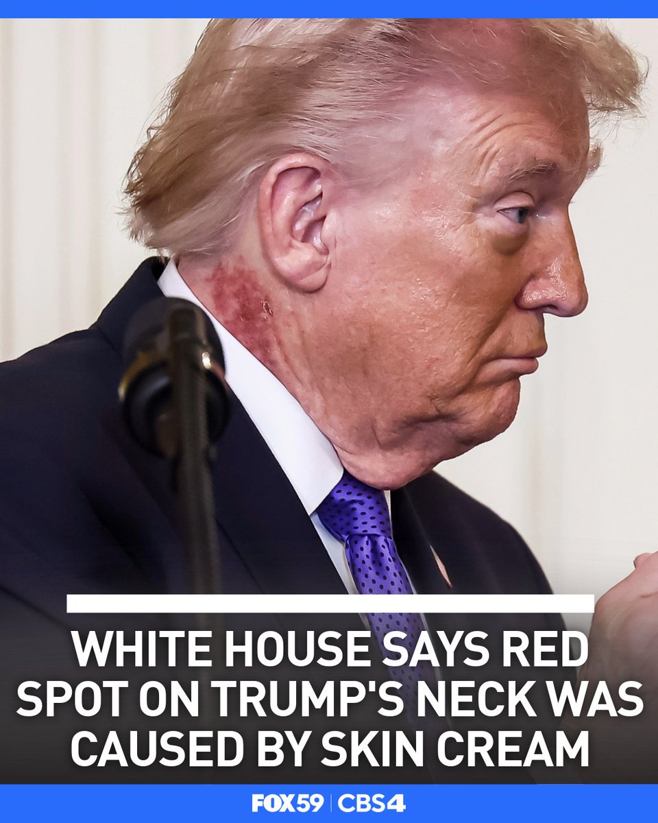 FOX59 News tweet media