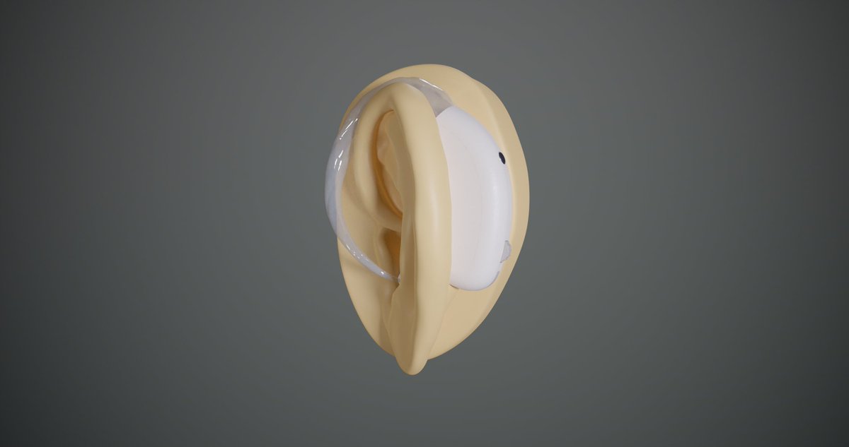 MajestyAssets's tweet photo. Just finished this Low Poly Hearing Aid 🎧

Game Ready • Rigged • Textured
Optimized for Unreal Engine
Perfect for:
🏥 Medical simulations
🎮 Games
🥽 VR / AR healthcare projects

Clean topology. Optimized mesh.
#3DModeling #UnrealEngine #GameDev #MedTech #LowPoly #IndieDev https://t.co/d8EbkcOqty
