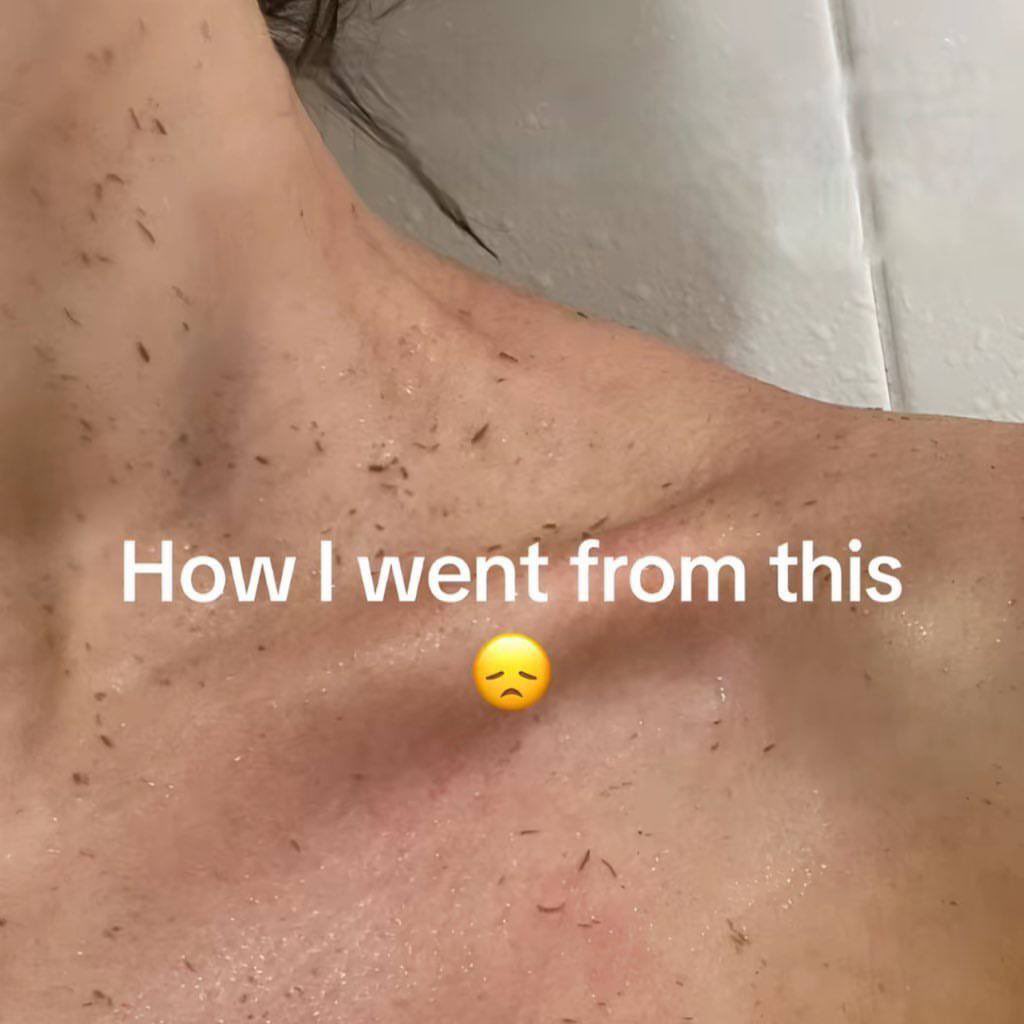 myrarhmnn's tweet photo. Dalam masa seminggu je wehhhh boleh dapat skin licin macam ni😭 buat tips Morrocan Hammam. Beauty secret popular kat overseas yg share tips ni— https://t.co/RrG8rN9B9J