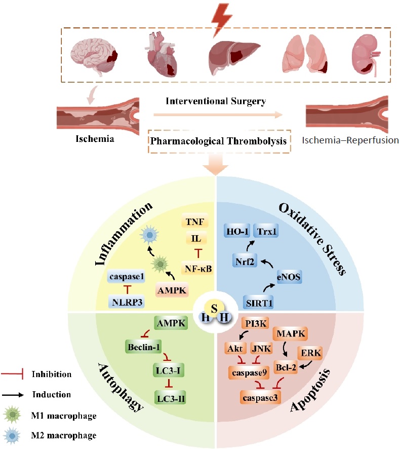STMPUB's tweet photo. Online now: Unlocking the #gasotransmitter: hydrogen sulfide as a multitarget regulator in ischemia–reperfusion injury. https://t.co/8ggZctdVFq #OrganProtection #MedicalResearch #H2STherapy #Cardioprotection #Nephrology #Hepatology #Pulmonology #Drug #TranslationalMedicine https://t.co/enPCAtfP2a