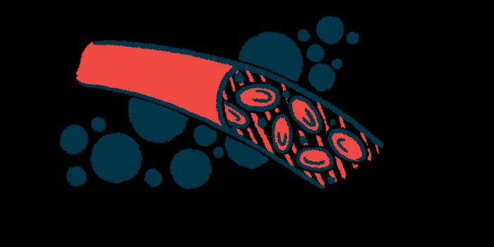 CFNewsToday's tweet image. Kaftrio was linked to lower insulin doses and less glucose variability after one year in adults with cystic fibrosis-related diabetes. buff.ly/eKMin3T #cysticfibrosis #cfwarrior #curecf #cysticfibrosislife