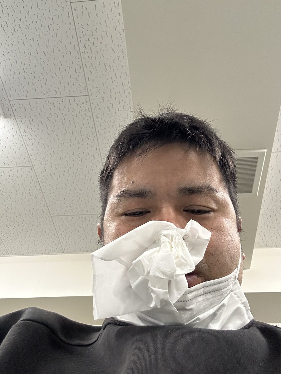 nisann14499's tweet photo. 花粉がすごーい笑
鼻水止まらないし、寝れなかった…
病院行きます。(ここまで酷くなかったのに…アレグラ効かない体質になった？のか効かない😭) https://t.co/WzQzl0bnF3