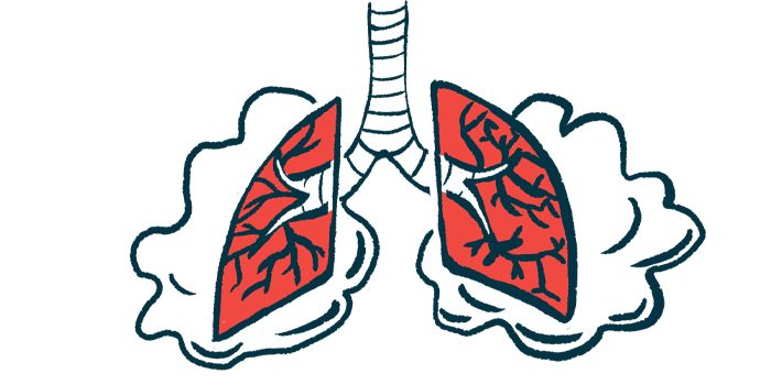 AncaVasculitis's tweet photo. Lung complications are common in AAV, affecting four in five patients, with some developing lasting damage, a study found. https://t.co/165OcMiBfa https://t.co/fHI76XZ5d6
