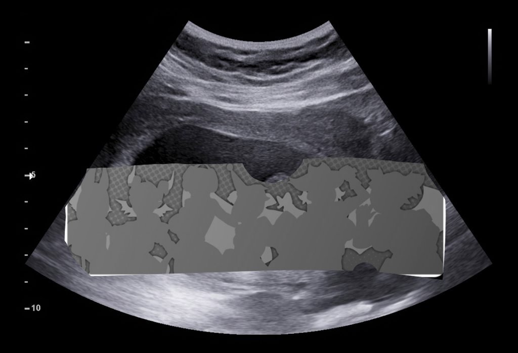 DoubleDDemon🦶😈 tweet media