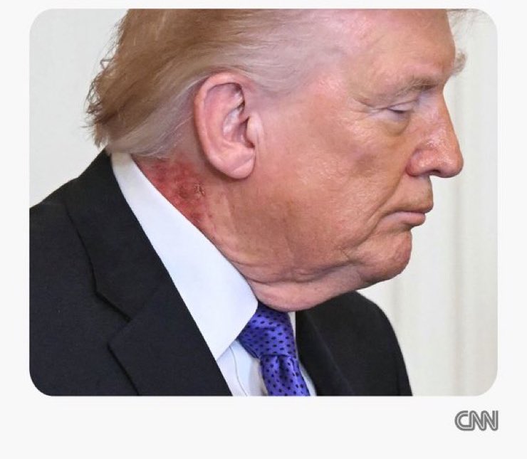 Davidson N tweet media