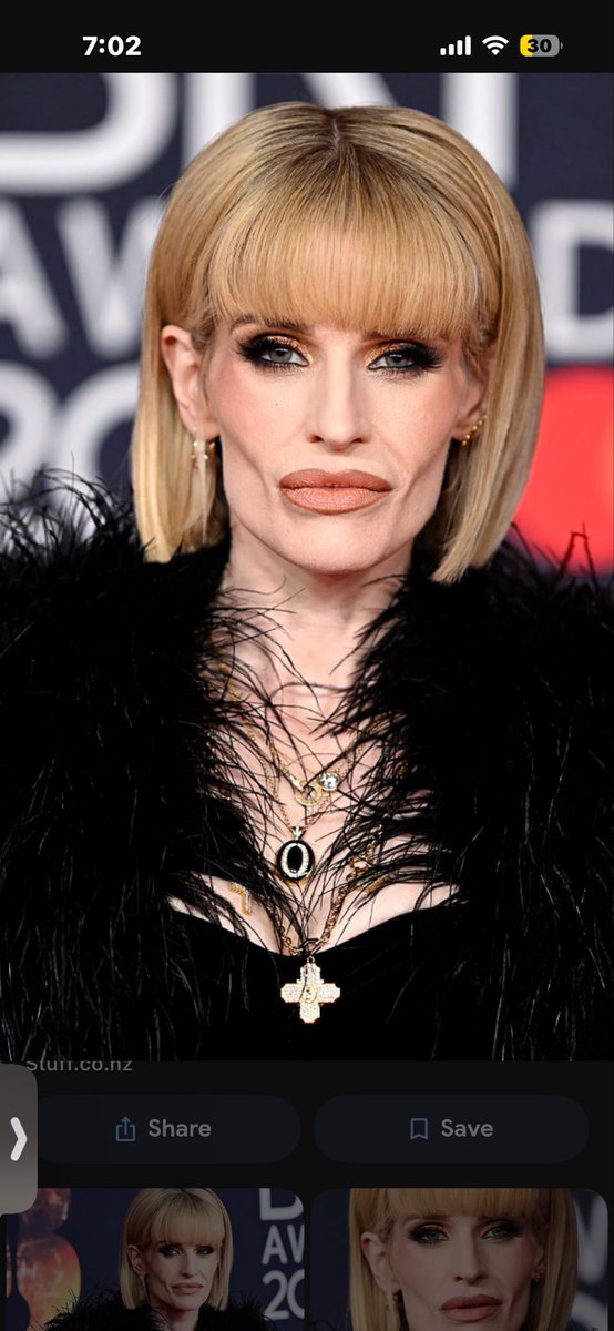 breaka97's tweet photo. OMG!!! Is she ok???? What’s going on @KellyOsbourne https://t.co/vqIOCwJq43