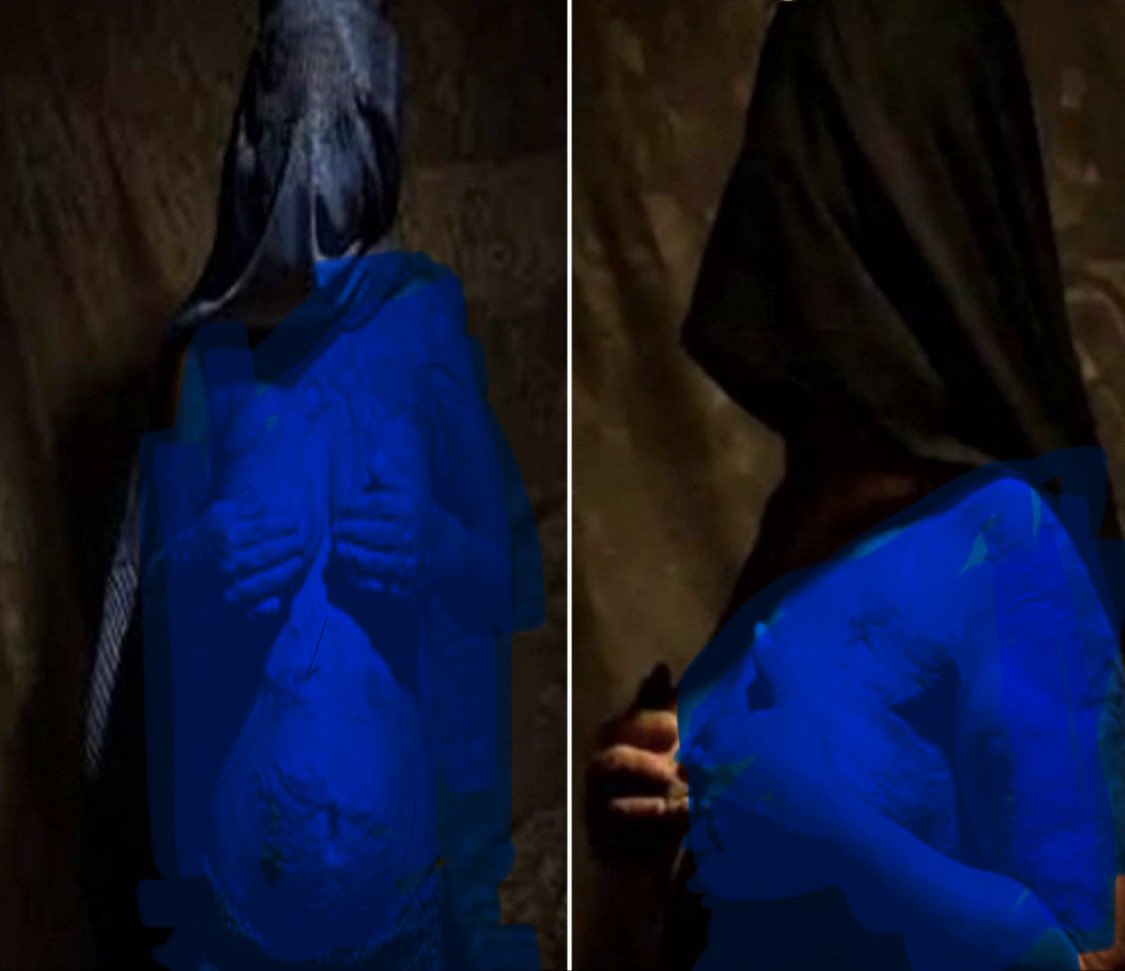 I am an Afghan woman.
When I speak about domestic violence, it is not just a word — it is my body. These scars are the result of torture in a home that was supposed to be safe.

I am not even thirty yet, but my body bears witness to the cruelty I endured.
The Taliban have