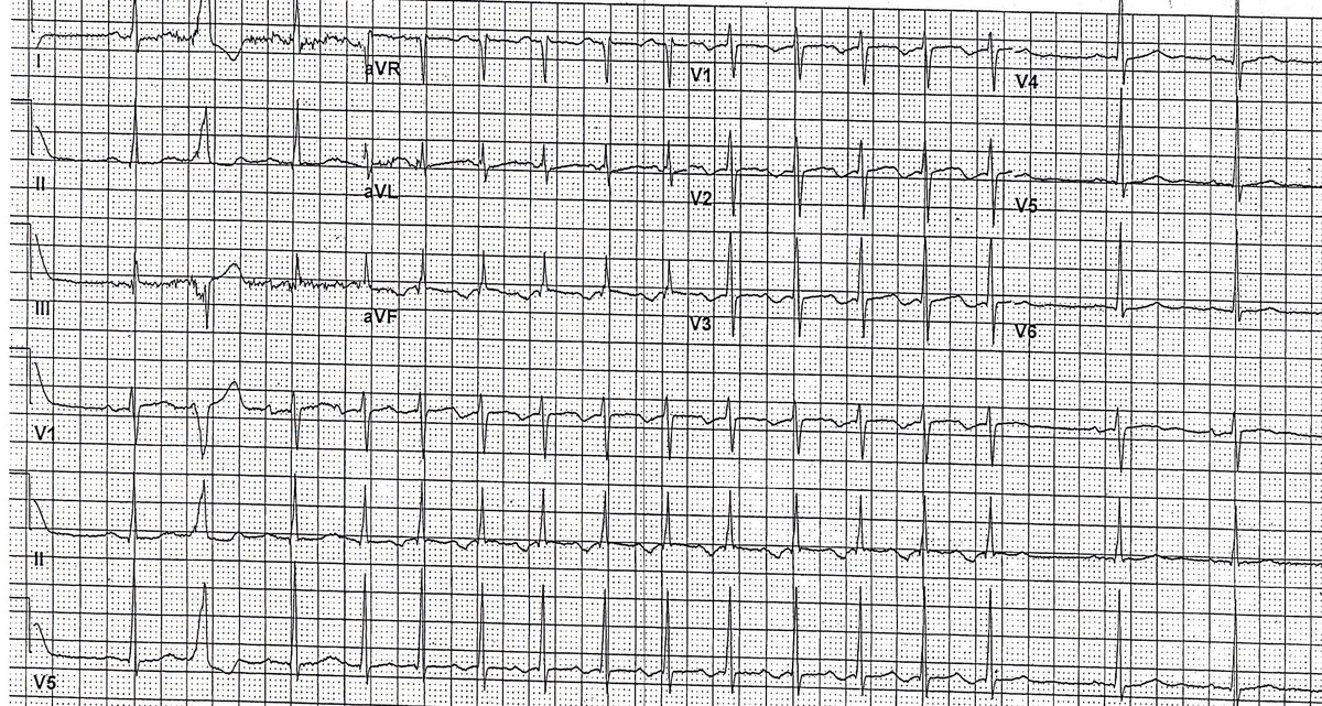 Philip J Podrid MD tweet media