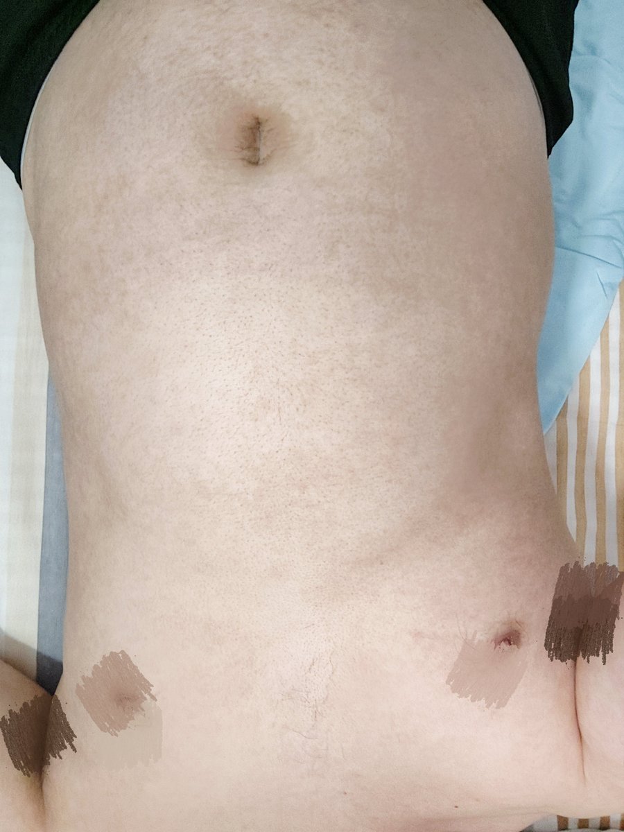 KinichIV's tweet photo. 元宵节快乐🥳🥳🥳
#bellyinflation
#bellystuffing
#撑大肚子
#mpreg
#malepregnancy 
#gains https://t.co/wfXTAn8swr