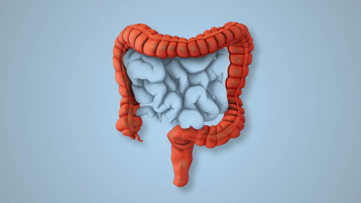 NewsMedical's tweet image. Struggling with IBS? 🥦 Experts say the low-FODMAP diet brings fast relief, but lasting results depend on personalized, evidence-based nutrition.  news-medical.net/news/20260302/… #GutHealth #IBS #Nutrition @Nutrients_MDPI