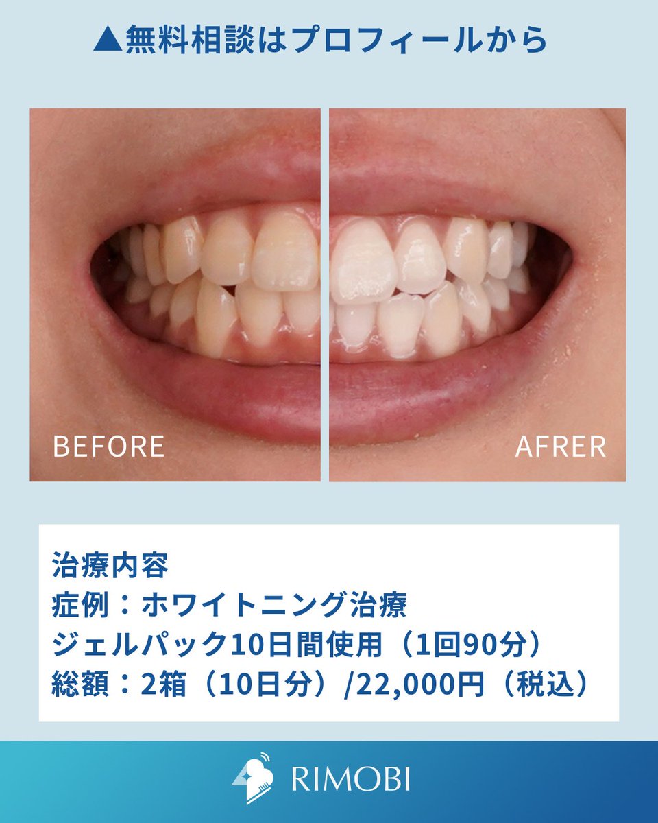 RIMOBI(リモビ)｜DENNOVATE(ディノベート)取扱 (@rimobi_dental