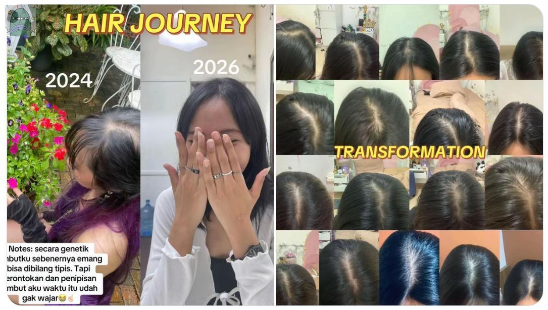 Tanyarlfes tweet media