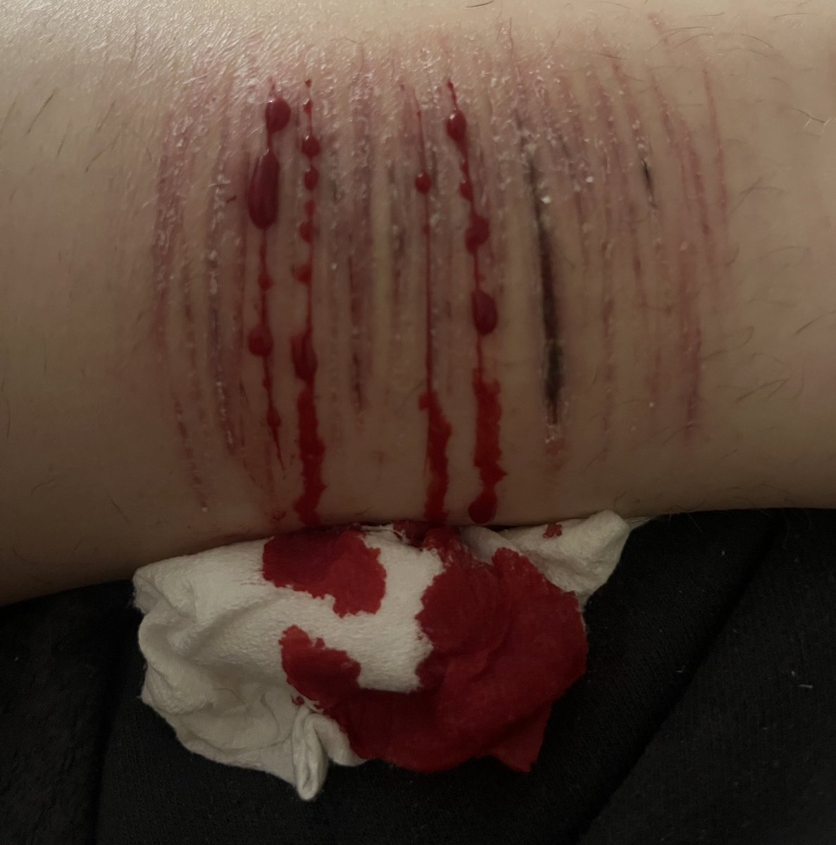 NKismeto's tweet photo. my skin is crying (ᴗ_ ᴗ。) https://t.co/c0i6VSRuQn