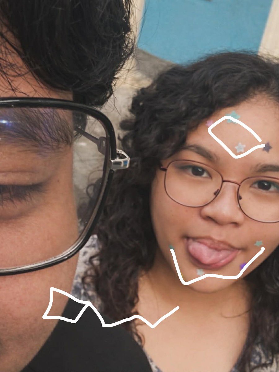 iaghtchu's tweet photo. her pimple patches is parang the big dipper cons kapag inalign BAHHAHAHAHAHAHA https://t.co/gimeugvKSi