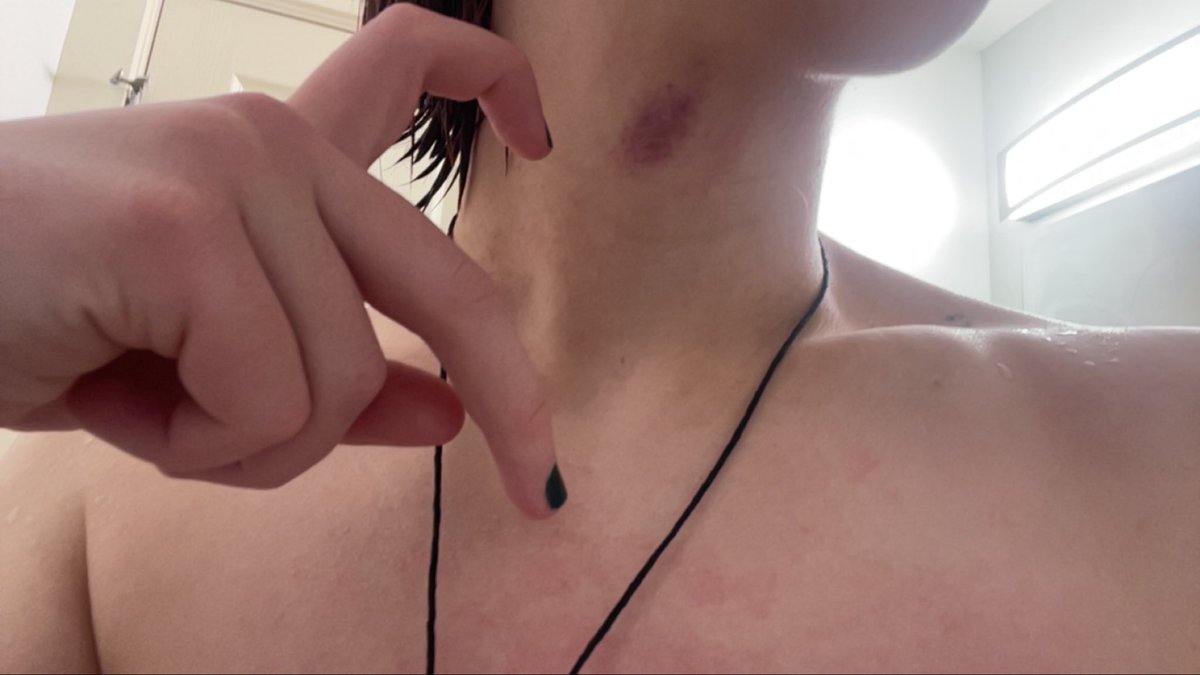 cinnamon_bunny_'s tweet photo. I love my hot puppy girl, it’s cute when she leaves her mark on me https://t.co/eXZQpE9FzP