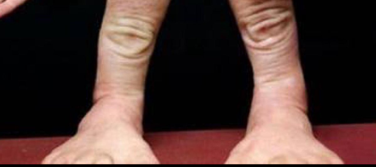 Human.exe has stopped working. 🗿