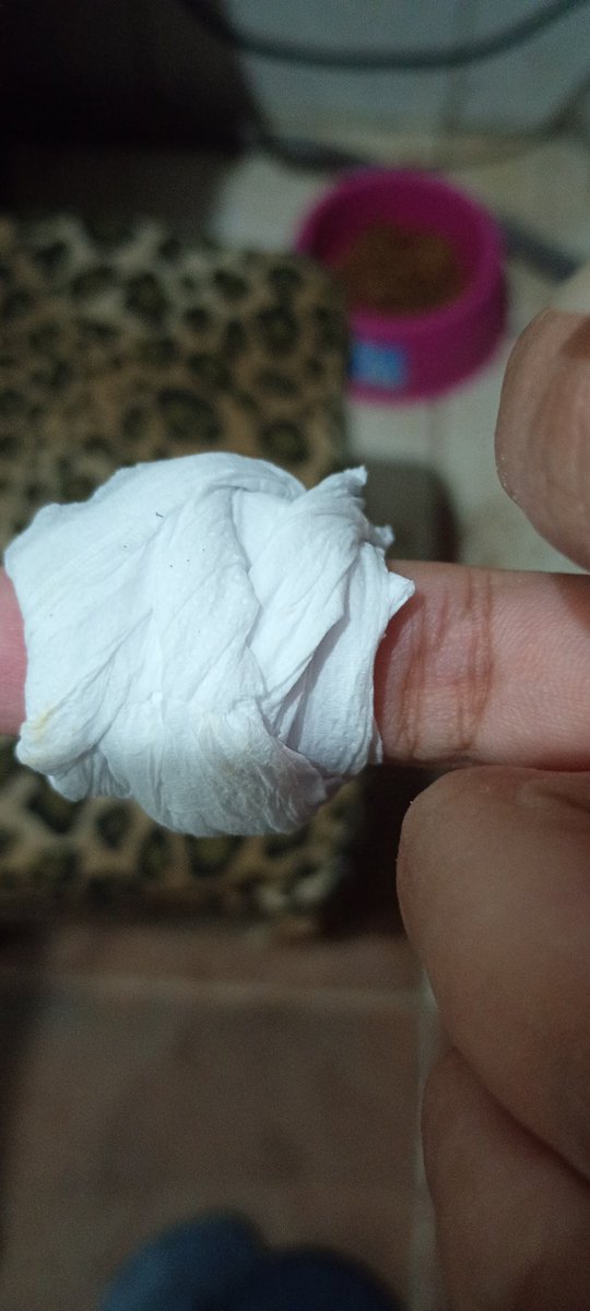 ANDRIELY_Sil's tweet photo. Me cortei fazendo comida e usei papel higiênico 😂 https://t.co/YDG05pth2F