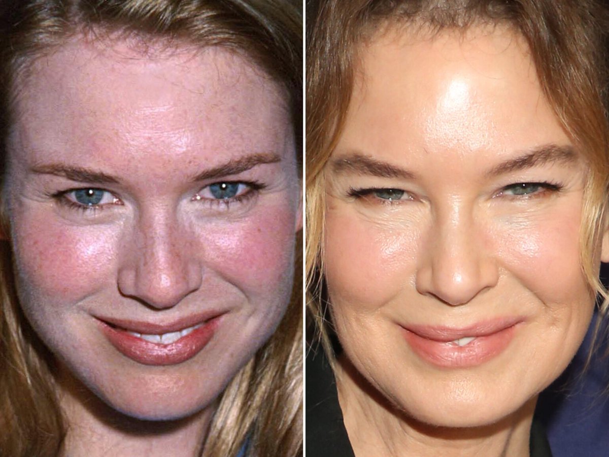 Micky Fitz tweet media