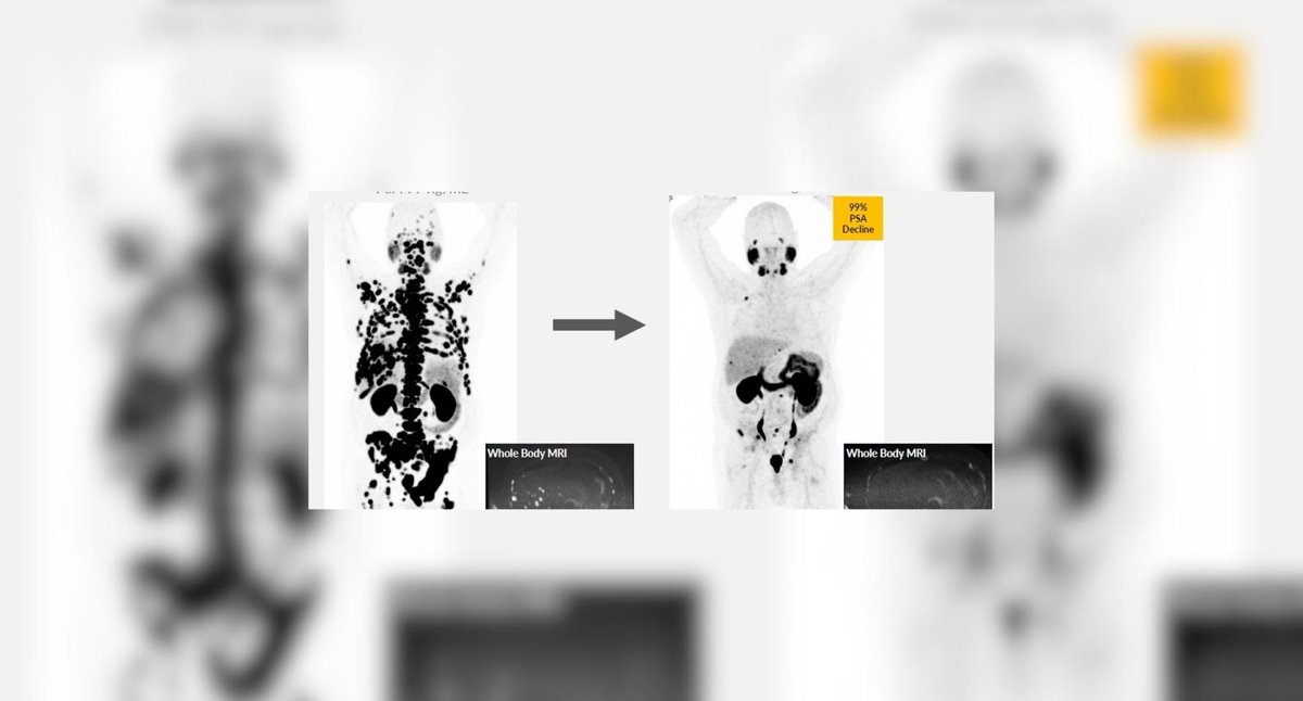 Topic of Cancer tweet media