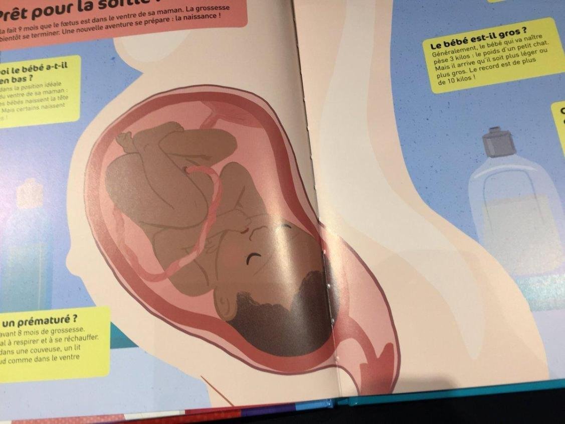 White Boi BNWO 🇫🇷 ♠ tweet media