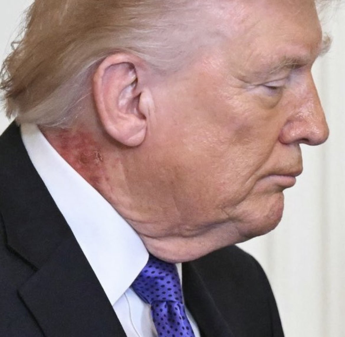 Jake Shields tweet media