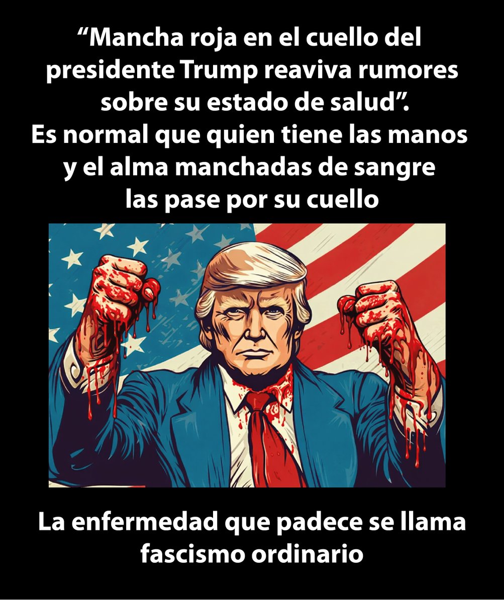 hsuarez2012's tweet photo. Este lunes, 2 de marzo, el presidente de Estados Unidos, Donald Trump, volvió a estar en el centro de la conversación pública luego de que varios fotógrafos captaran una marca roja en su cuello durante un acto oficial en la Casa Blanca. https://t.co/4CzUW1kBFJ