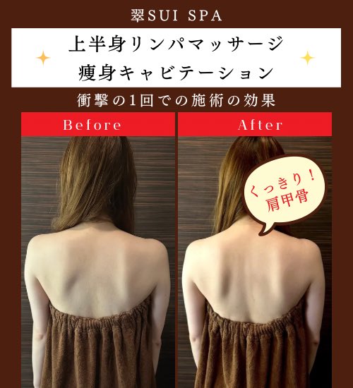 sui_spa's tweet photo. 手技とマシンのW技術でくっきり肩甲骨出現🤩✨
華奢な姿が手に入る💖💖💖
春婚・フォト婚・前撮りを控えた花嫁におすすめ🫶🏽✨
ご予約はこちらから💁🏽‍♀️⬇️⬇️
https://t.co/WEcagAQTg5

#フォト婚　#表参道ブライダルエステ　#プレ花嫁　#花嫁美容　#天使の羽 https://t.co/XX5QZOGd5J