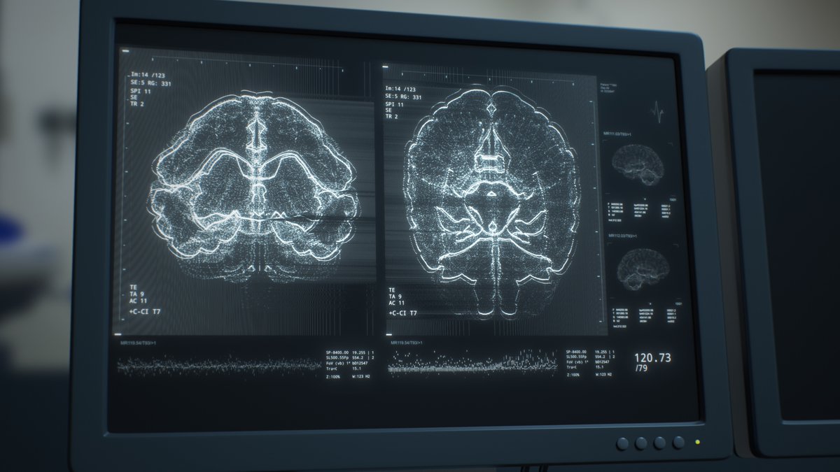 IntClinTrials's tweet photo. 🧠Bridging the translation gap in neuroscience R&amp;D
✏️Johannes Streffer at @LundbeckUS 
Read here: https://t.co/lhW0C2sVtr https://t.co/1W0kMYjOkn