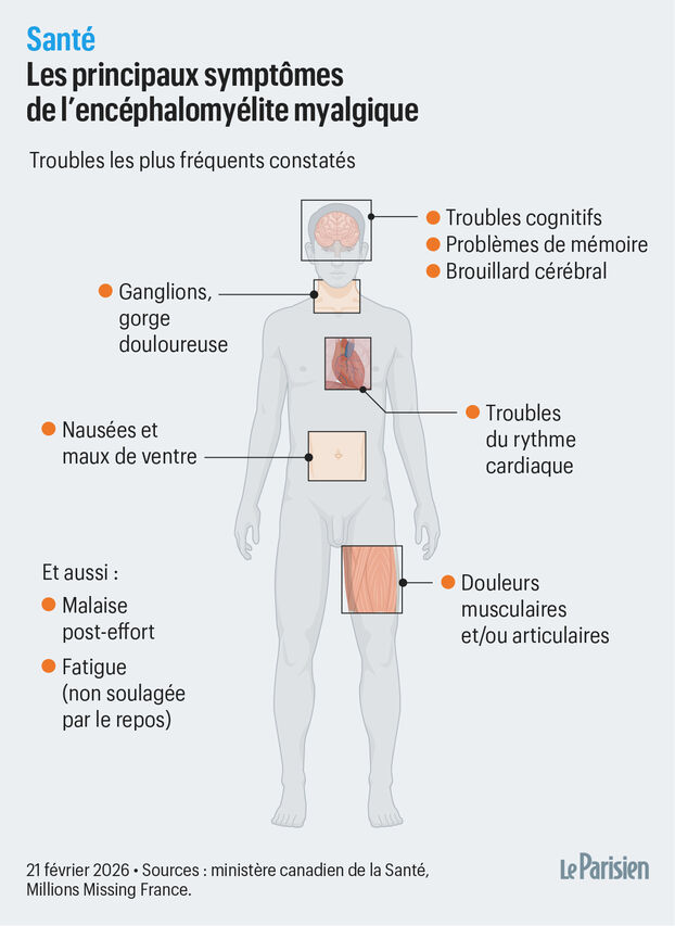 nicolasberrod's tweet photo. Les symptômes les plus fréquents sont une profonde fatigue, jusqu’à rendre impossibles les tâches du quotidien.

Mais aussi douleurs musculaires, mal à dormir, "brouillard cérébral" avec difficultés à se concentrer, etc. Ni sommeil ni repos ne permettent d’aller mieux.

5/10