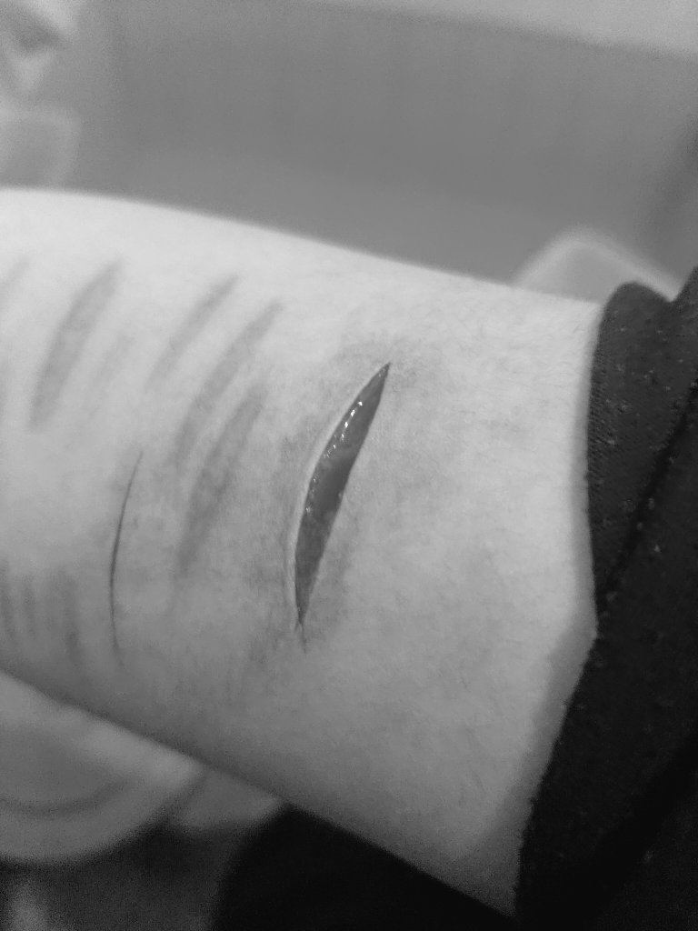 himariaawho's tweet photo. TW!! sh, fresh scar!! icl just ignore my last post
#shtwt https://t.co/JDUOLjElIn