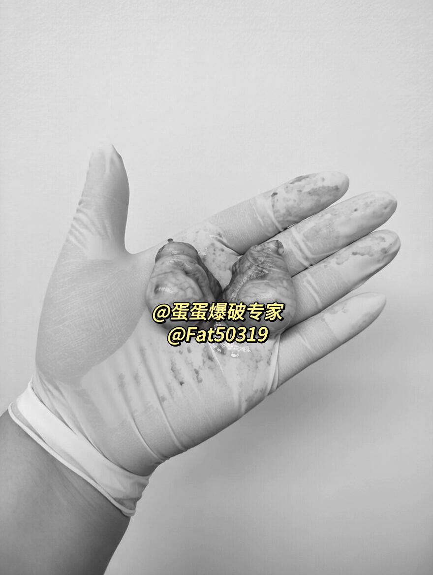 蛋蛋爆破专家 tweet media