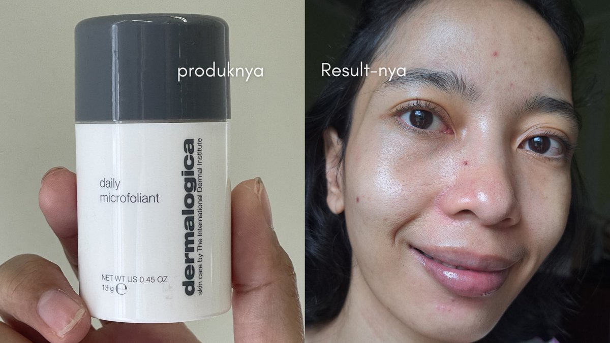 🫂skinker sobat grinjelan KWKWK. Aku selalu pake Daily Microfolliant punyanya Dermalogica, kalau mulai panen whiteheads ma komedo. Thank poll buat yang nge-share brand enih waktu awal-awal aku belum tau nih brand.

#NoiseoffResulton