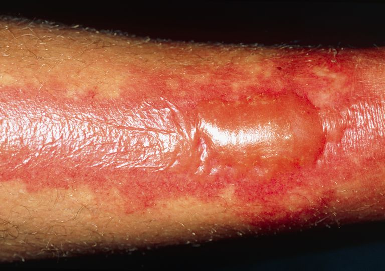 Яizal do tweet media