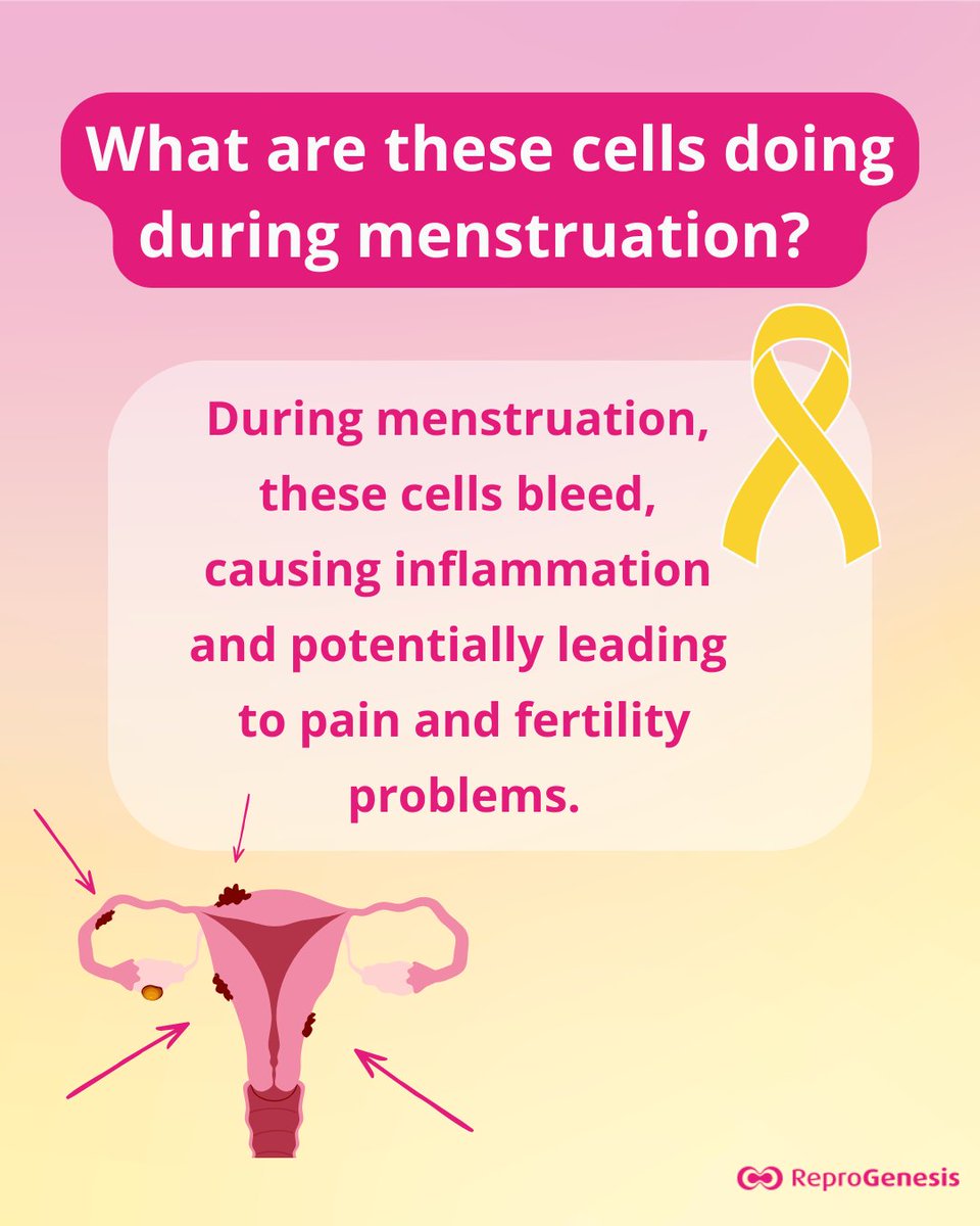 ReproGenesis's tweet photo. 💛 March is #Endometriosis Awareness Month.

Endometriosis is not just a “painful period.”

Let’s talk about it. This time with our 👨‍⚕ #IVF specialist, MUDr. Maděrka, Ph.D. 
@ReproGenesis 
Share to spread awareness. 💛
 #marchinyellow  #womenshealth #reproductivehealth https://t.co/KWWxVC72iI