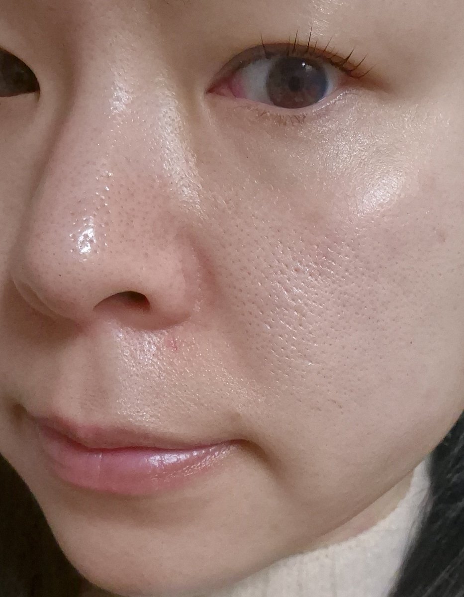 kore_ai52's tweet photo. 最近毛穴がましになった理由👀❤️
めっちゃ私に合うクレンジングに出会って
これのおかげで毛穴ケア追加でする頻度も減ったし最高🥹
メガ割でめっちゃ安いから私も購入🫣
1枚目_数日前
2枚目_去年のクレンジング変える前
3枚目_去年の化粧浮き最悪
#kindstep #メガ割 https://t.co/4U3DaCF25F