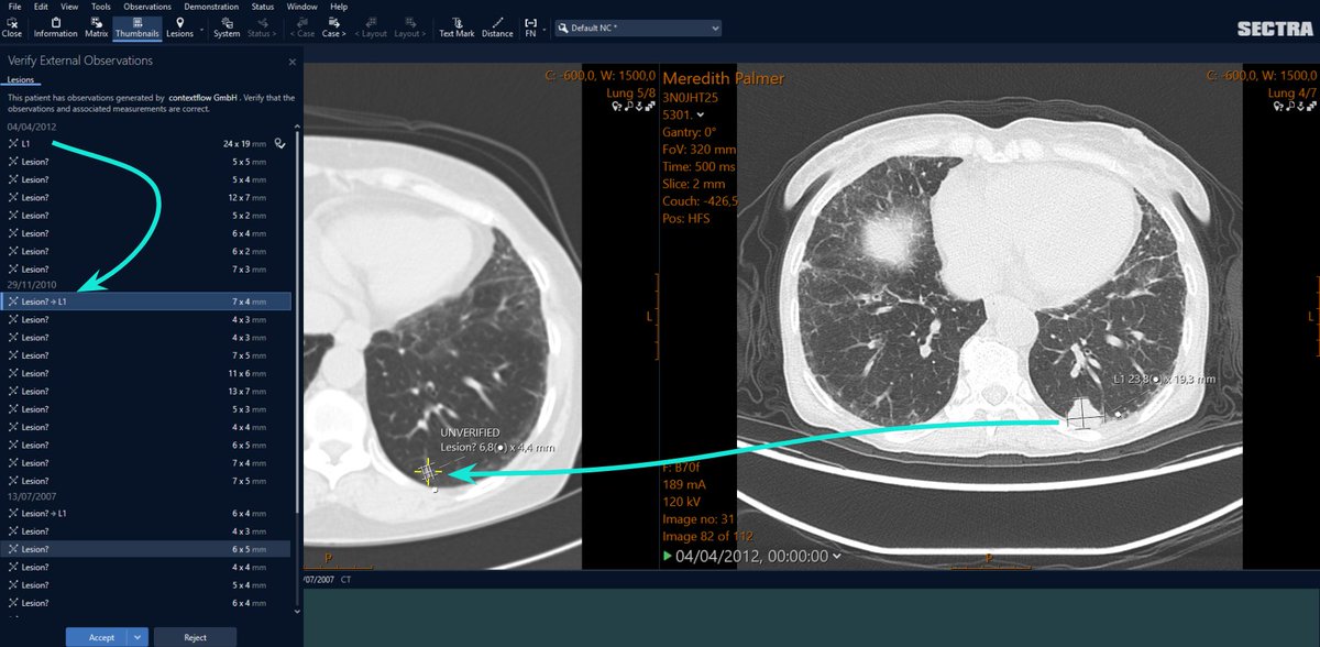 contextflow tweet media