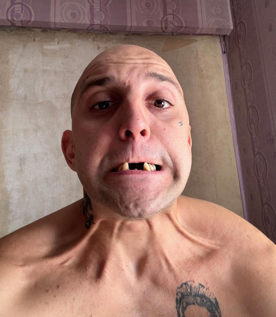 Killarcho0 tweet media