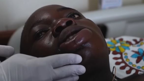 sholard_mancity's tweet photo. It’s not only Mwingi. In Kwale, a man was bitten on the mouth by a snake while sleeping. He tried using a “black stone”, it didn’t work. He survived after hospital treatment.

If snakes can bite someone in a toilet or while asleep, how do communities realistically reduce risk?

We need serious prevention strategies and public education.