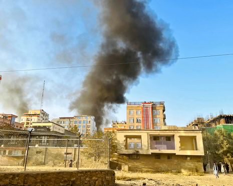 Zohal Azra زحل آزره tweet media