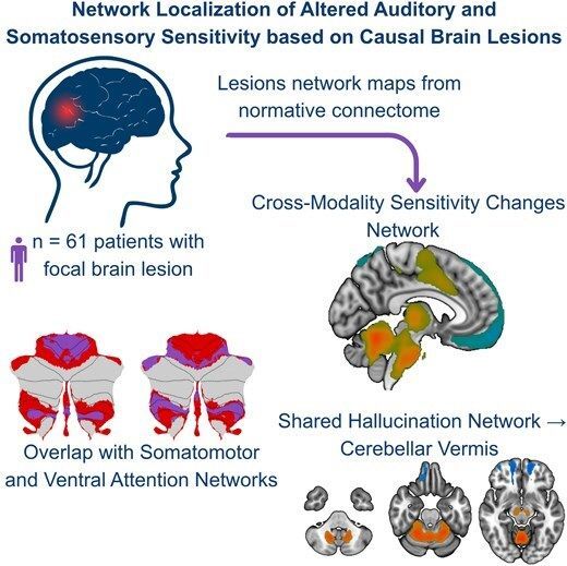 @BrainComms tweet media