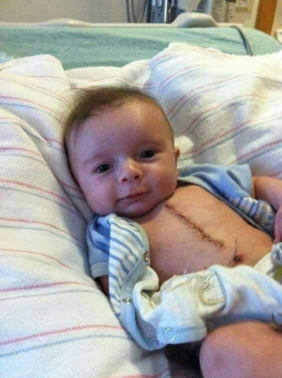 Farha0__'s tweet photo. 3 Month old survive against open heart surgery, Nobody gave him even 1 Like, Amen &amp; Share !!! https://t.co/KmuHqDfTxZ